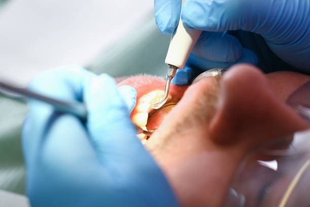 Best Weekend Emergency Dentist in College, AK
