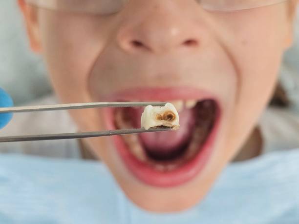 Best Pediatric Emergency Dentist in College, AK