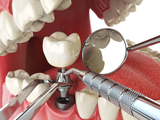 Best Emergency Dental Care for Trauma or Injury in College, AK